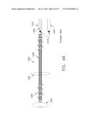 Rotate-to-Advance Catheterization System diagram and image