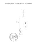 Rotate-to-Advance Catheterization System diagram and image