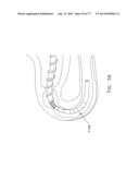 Rotate-to-Advance Catheterization System diagram and image