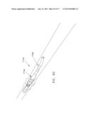 Rotate-to-Advance Catheterization System diagram and image