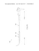 Rotate-to-Advance Catheterization System diagram and image