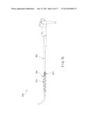 Rotate-to-Advance Catheterization System diagram and image