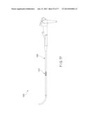 Rotate-to-Advance Catheterization System diagram and image