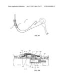 Rotate-to-Advance Catheterization System diagram and image