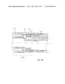 Rotate-to-Advance Catheterization System diagram and image