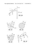 METHODS, DEVICES AND SYSTEMS FOR TREATING AND/OR DIAGNOSIS OF DISORDERS OF     THE EAR, NOSE AND THROAT diagram and image