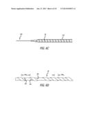 METHODS, DEVICES AND SYSTEMS FOR TREATING AND/OR DIAGNOSIS OF DISORDERS OF     THE EAR, NOSE AND THROAT diagram and image