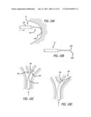 METHODS, DEVICES AND SYSTEMS FOR TREATING AND/OR DIAGNOSIS OF DISORDERS OF     THE EAR, NOSE AND THROAT diagram and image