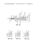 METHODS, DEVICES AND SYSTEMS FOR TREATING AND/OR DIAGNOSIS OF DISORDERS OF     THE EAR, NOSE AND THROAT diagram and image