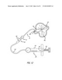 METHODS, DEVICES AND SYSTEMS FOR TREATING AND/OR DIAGNOSIS OF DISORDERS OF     THE EAR, NOSE AND THROAT diagram and image