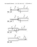 METHODS, DEVICES AND SYSTEMS FOR TREATING AND/OR DIAGNOSIS OF DISORDERS OF     THE EAR, NOSE AND THROAT diagram and image