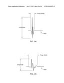 METHODS AND APPARATUSES FOR REMODELING TISSUE OF OR ADJACENT TO A BODY     PASSAGE diagram and image