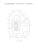 BONE PLATE SYSTEM AND METHOD diagram and image