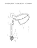 BONE PLATE SYSTEM AND METHOD diagram and image