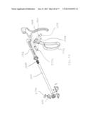 BONE PLATE SYSTEM AND METHOD diagram and image