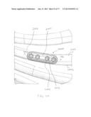 BONE PLATE SYSTEM AND METHOD diagram and image