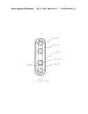 BONE PLATE SYSTEM AND METHOD diagram and image