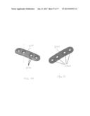 BONE PLATE SYSTEM AND METHOD diagram and image