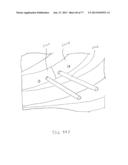 BONE PLATE SYSTEM AND METHOD diagram and image