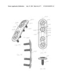 BONE PLATE SYSTEM AND METHOD diagram and image