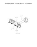 BONE PLATE SYSTEM AND METHOD diagram and image