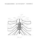 BONE PLATE SYSTEM AND METHOD diagram and image