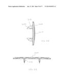 BONE PLATE SYSTEM AND METHOD diagram and image