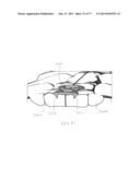 BONE PLATE SYSTEM AND METHOD diagram and image