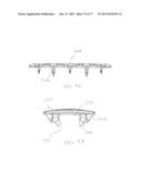 BONE PLATE SYSTEM AND METHOD diagram and image