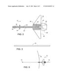 SURGICAL NAVIGATION diagram and image