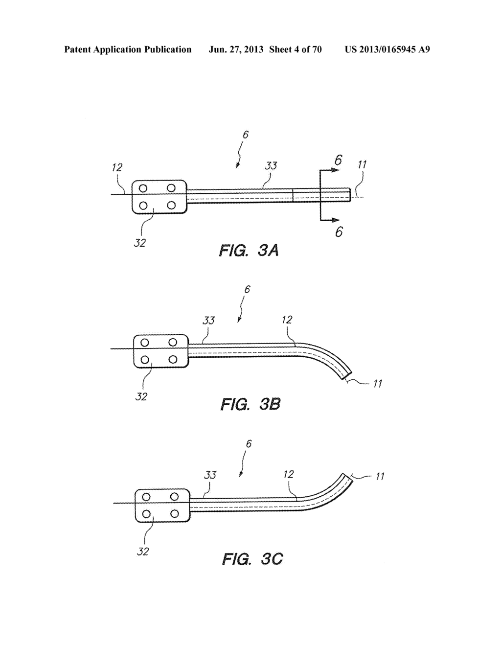 METHODS AND DEVICES FOR CONTROLLING A SHAPEABLE INSTRUMENT - diagram, schematic, and image 05