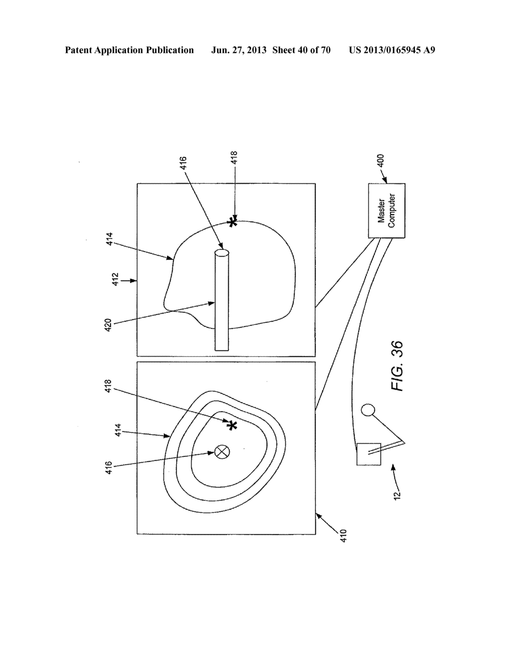 METHODS AND DEVICES FOR CONTROLLING A SHAPEABLE INSTRUMENT - diagram, schematic, and image 41