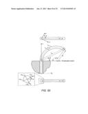 METHODS AND DEVICES FOR CONTROLLING A SHAPEABLE INSTRUMENT diagram and image