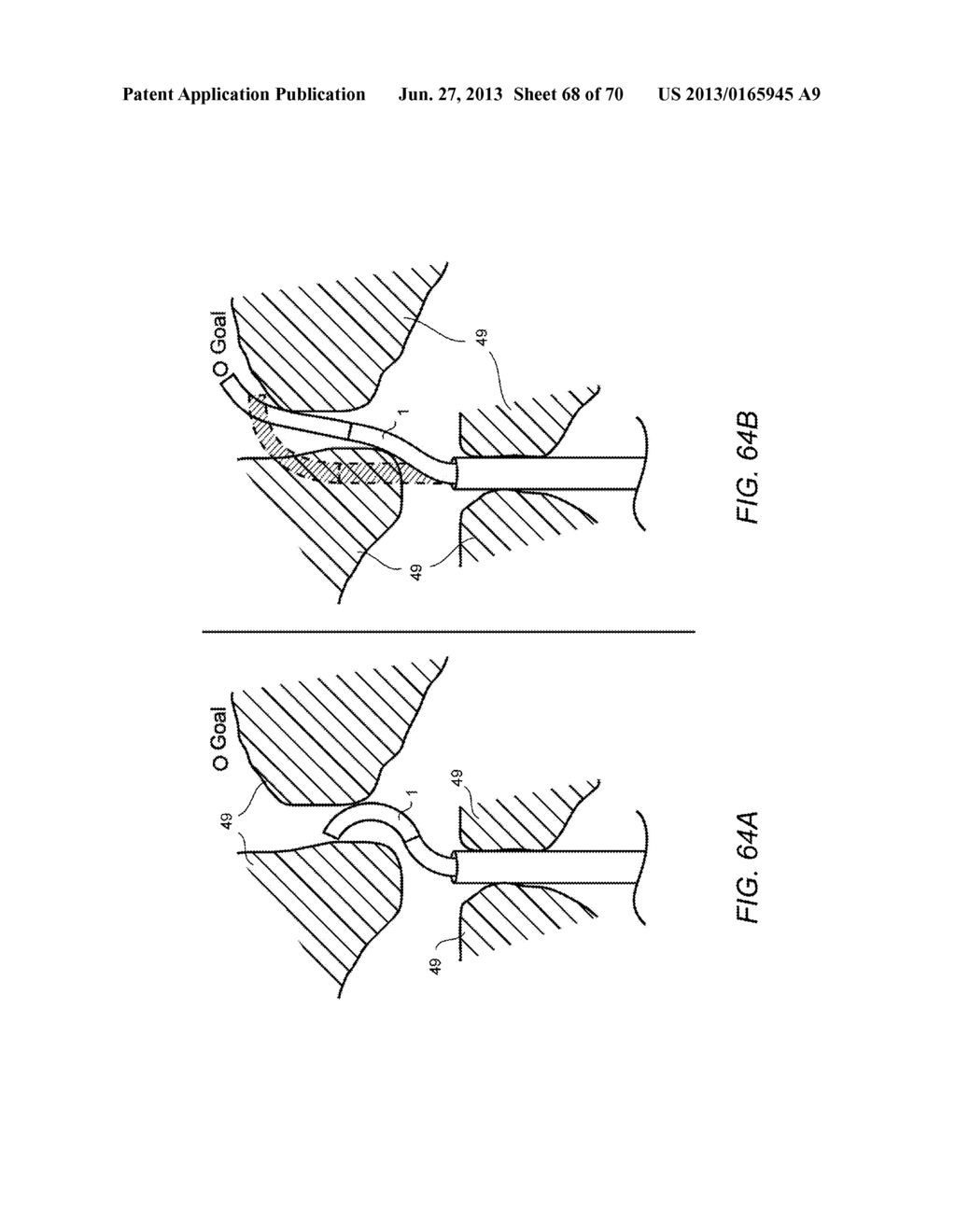 METHODS AND DEVICES FOR CONTROLLING A SHAPEABLE INSTRUMENT - diagram, schematic, and image 69