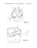 TENSIONABLE KNOTLESS ANCHOR SYSTEMS AND METHODS OF TISSUE REPAIR diagram and image