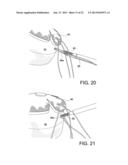 TENSIONABLE KNOTLESS ANCHOR SYSTEMS AND METHODS OF TISSUE REPAIR diagram and image