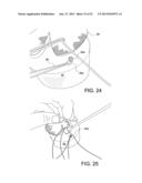 TENSIONABLE KNOTLESS ANCHOR SYSTEMS AND METHODS OF TISSUE REPAIR diagram and image