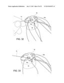 TENSIONABLE KNOTLESS ANCHOR SYSTEMS AND METHODS OF TISSUE REPAIR diagram and image