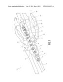 WRIST FUSION PLATE diagram and image