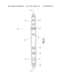 WRIST FUSION PLATE diagram and image