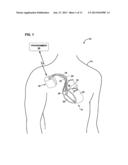 FAULT TOLERANT PACING diagram and image