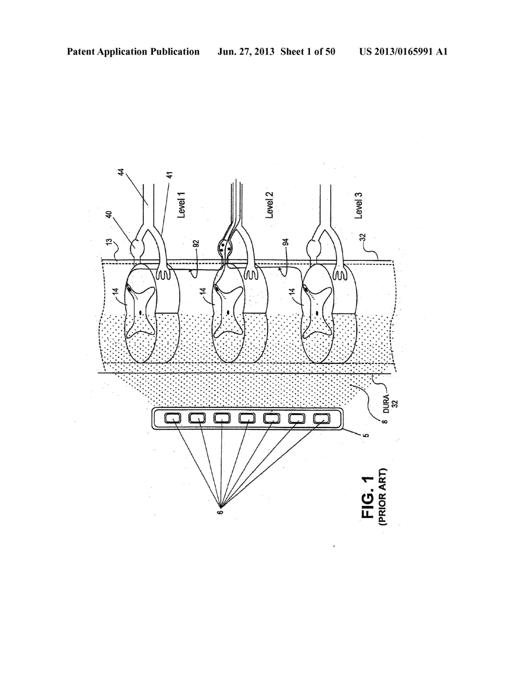 NEUROSTIMULATION METHODS AND SYSTEMS - diagram, schematic, and image 02