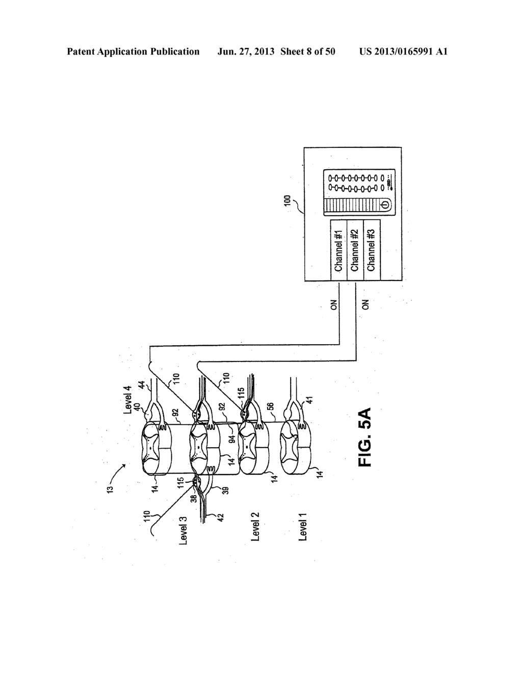 NEUROSTIMULATION METHODS AND SYSTEMS - diagram, schematic, and image 09