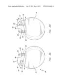 SETSCREW CONTACT FOR IMPLANTABLE PULSE GENERATOR diagram and image