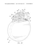 SETSCREW CONTACT FOR IMPLANTABLE PULSE GENERATOR diagram and image