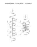 HYBRID AORTIC ARCH REPLACEMENT diagram and image