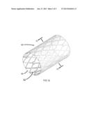 EXPANDABLE STENT WITH WRINKLE-FREE ELASTOMERIC COVER diagram and image