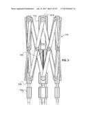 Actively Controllable Stent, Stent Graft, Heart Valve and Method of     Controlling Same diagram and image