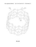 Actively Controllable Stent, Stent Graft, Heart Valve and Method of     Controlling Same diagram and image