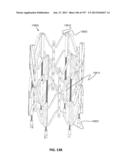 Actively Controllable Stent, Stent Graft, Heart Valve and Method of     Controlling Same diagram and image